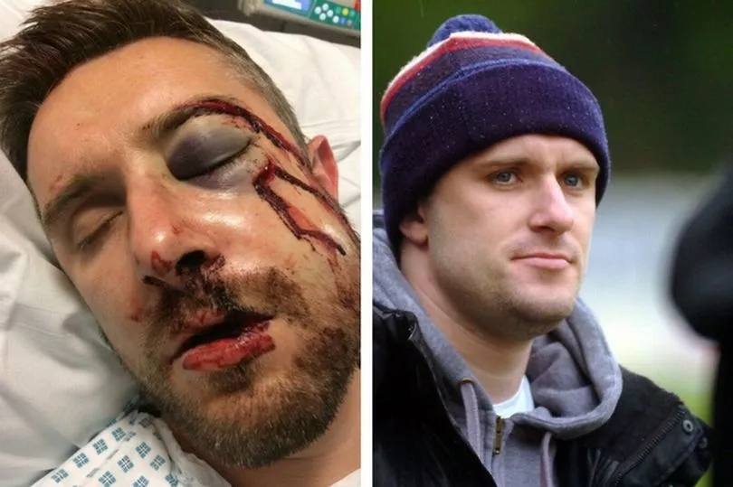 Yates-injury-story.jpg